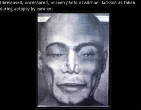 michael jackson autopsy report.